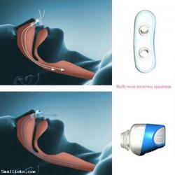 Health Nose Snore Stop Snoring Night Nose Breathing Apparatus Air Purifier Stop Grinding Relieve Anti-smog PM2.5 Apparatus